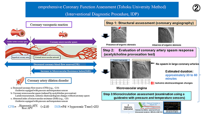 図7 包括的冠動脈機能評価（東北大学方式）